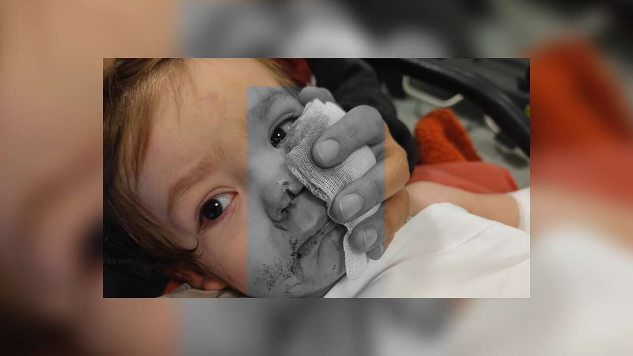 Başkentte 2 çocuğu yaralayan pitbull cinsi köpeğin sahibi gözaltına alındı