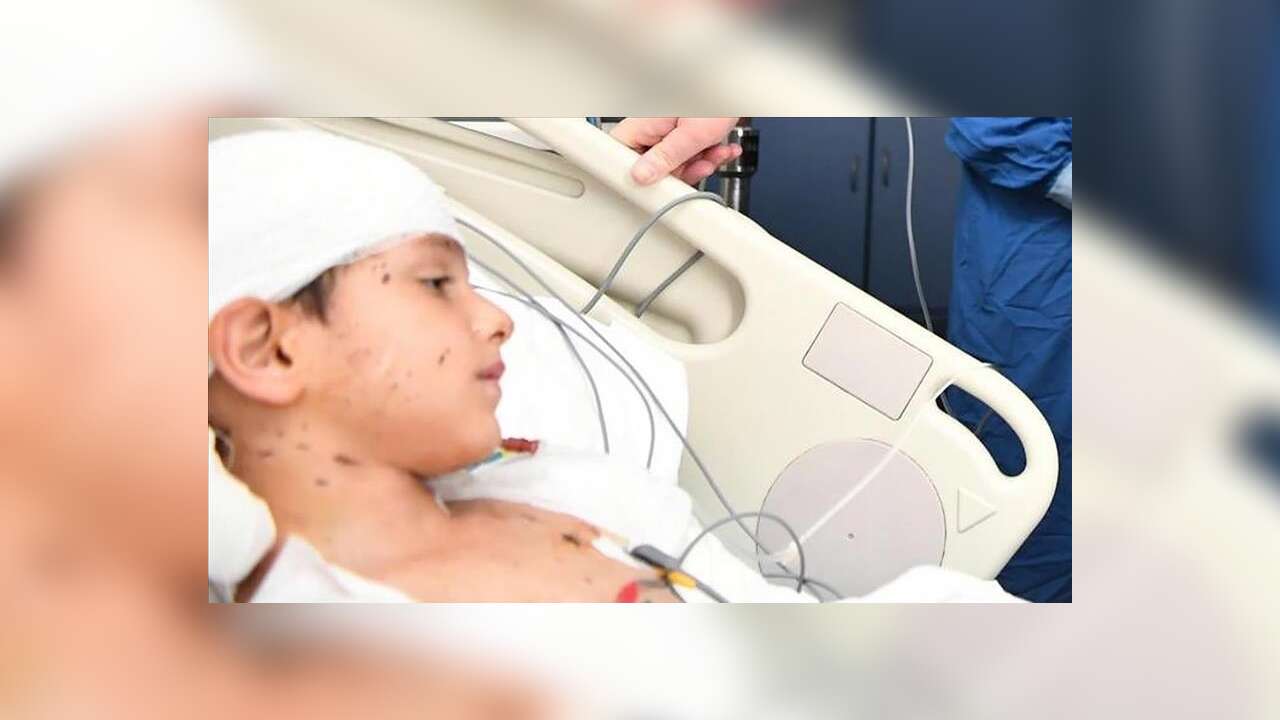 Ankara'da sahipsiz köpeklerin saldırdığı Tunahan'ın ailesine 5 milyon lira manevi tazminat kararı