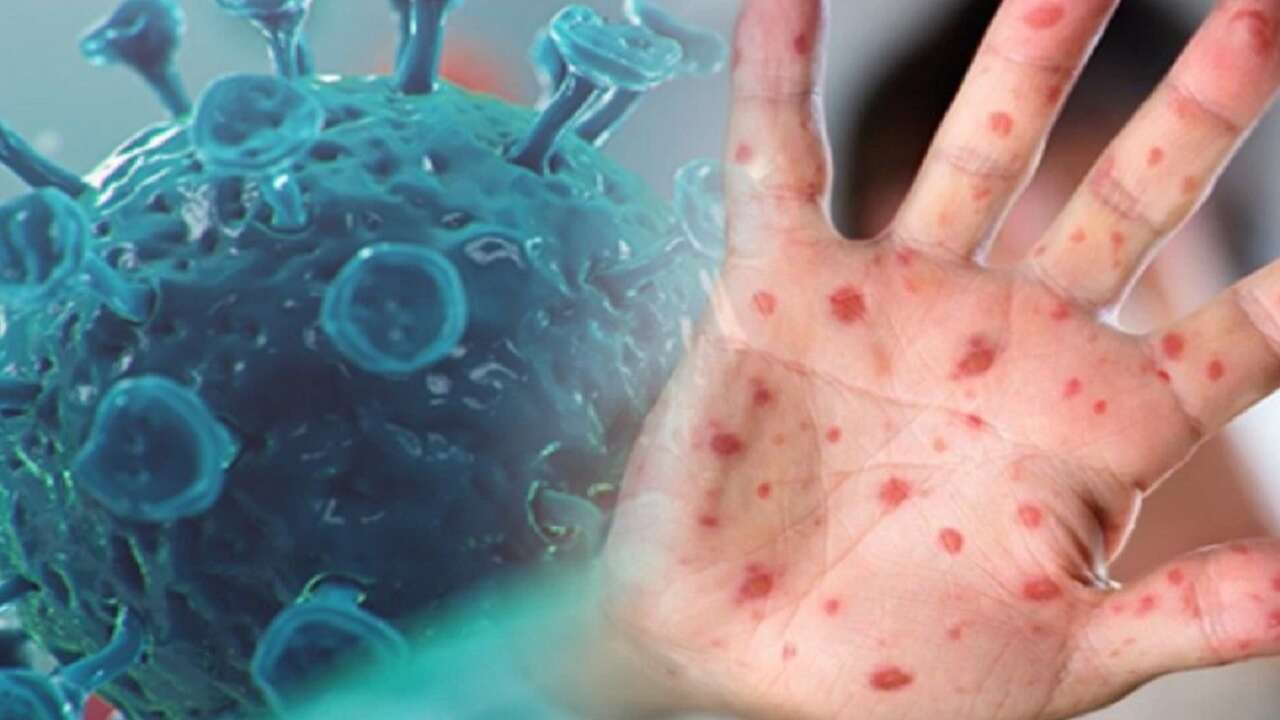 Afrika CDC, M çiçeği salgını için "kıtasal acil durum" ilanını sona erdirdi