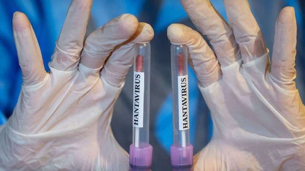 Sağlık Bakanlığı: Türk vatandaşların test sonuçları negatif