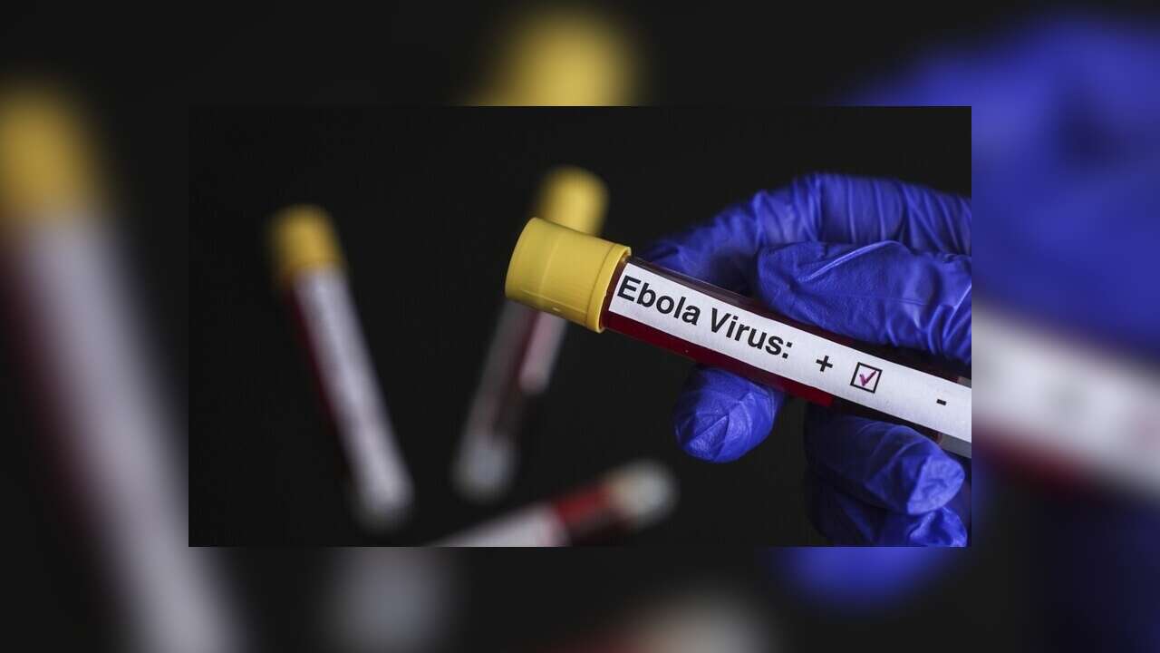 DSÖ, Ebola salgınının görüldüğü KDC ve Uganda'ya seyahat ve ticaret kısıtlaması önermiyor