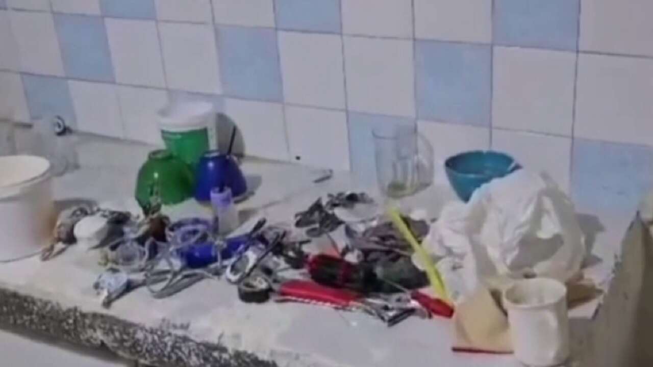 Kaçak diş laboratuvarından akılalmaz görüntüler!