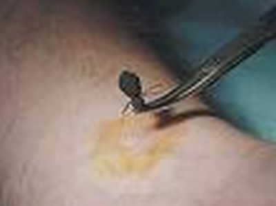 Prof. Dr. Gaye Usluer: Ribavirin, KKKA tedavisi için ruhsatlandırılmış ilaç değil!.