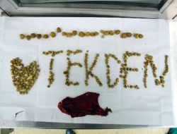 Safra Kesesinden 250 Adet Taş Çıktı!