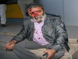 Yozgat'ta Gazeteciye Çirkin Saldırı