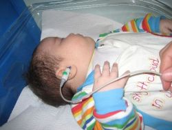 İşitme Taraması Binlerce Bebeği Sesle Tanıştırdı