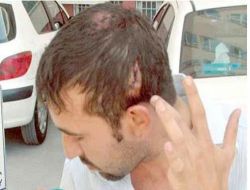 Yanlışlıkla Kaçırıp Darp Ettiler, 'pardon, Hakkını Helal Et' Diyerek Kan Parası Verdiler