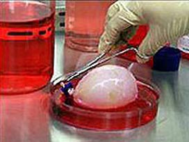 Organ kaçakçılığı iddianamesi kabul edildi!