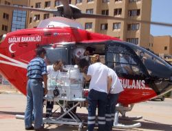 İkizler Görebilme Umuduyla Uçtu