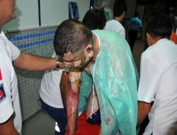 Çimento Fabrikasında Patlama: 3 İşçi Ağır Yaralandı!