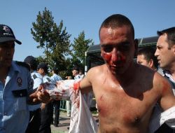 Akın Birdal'a Saldıran Üniversite Öğrencisinin Durumu Kritik