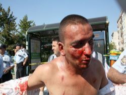 Akın Birdal'a Kafa Atan Saldırgan: "Kız Arkadaşımdan Ayrıldığım İçin Moralim Bozuktu"