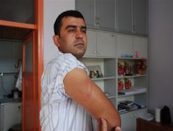 Eğirdir Belediye Başkanı'nın Şoförüne Sopalı Saldırı