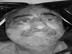 3 Hafta Önce Bulunan Cesedin Kimliği Hala Tespit Edilemedi