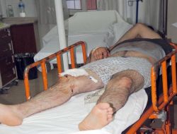 Afyonkarahisar'da, Bayramın İlk Günü 45 Acemi Kasap Kendini Yaraladı