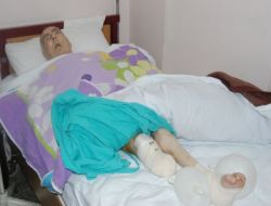 Ameliyatta 'yanlış Bacak Kesildi' İddiasıyla Suç Duyurusunda Bulundular