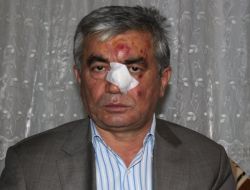 Bayraklı'da Temizlik İşleri Müdürü Korumaların Saldırısına Uğradı