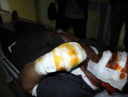 Terör Örgütü Yandaşları Lokantada Yemek Yiyen Vatandaşı Yaktı