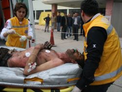 Yüksek Gerilim Hattına Kapılan 2 Kişi Ağır Yaralandı