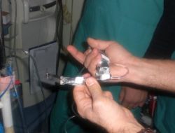 Öğrenciler, Kırılan Dişlerin Soluk Borusuna Kaçmasını Önleyen Cihaz Geliştirdi