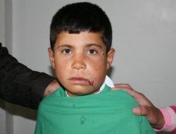 Patnos'taki Patlamada Yaralanan Duru: Bulduğumuz Cisimle Oynarken Patlama Oldu