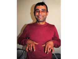 Çürük Raporunu Kaldırtıp 18 Ay Gönüllü Askerlik Yaptı