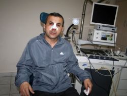 Eczacı Kalfası Doktorun Burnunu Kırdı