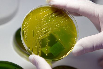 Salgının kaynağı bulundu