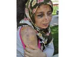 Kocasının Elinden İkinci Kattan Atlayarak Kurtuldu