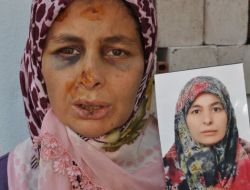 Eşinin Vahşet Uyguladığı Kadına Balıkesir Valiliği De Sahip Çıktı