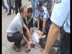 Kendini Kesen Özürlü Genç, Babasını Dövmüş